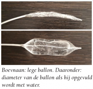 ballon-endoscoop