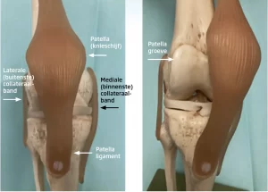 mediale-patella-luxatie-knie